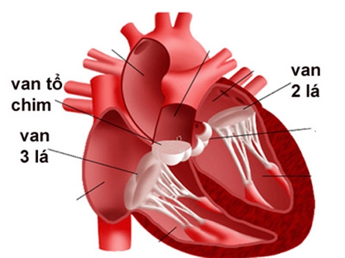 Sa van hai lá – căn bệnh tim phổ biến ở nữ giới