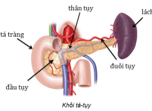 Ung thư tuyến tụy