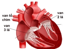 Sa van hai lá – căn bệnh tim phổ biến ở nữ giới